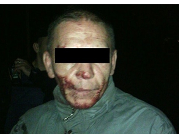 Мужчина в кровь Мужчина в кровь