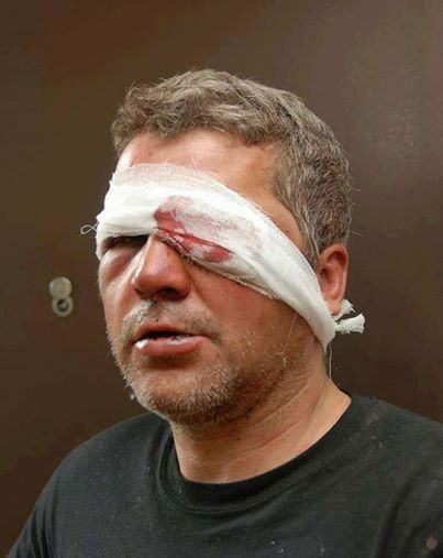 Федорченко Александр - побитый запорожский боец АТО Федорченко Александр - побитый запорожский боец АТО