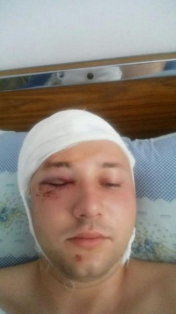 Полицейский, которого избили Полицейский, которого избили