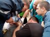 Спасают палец девочке в Токмаке